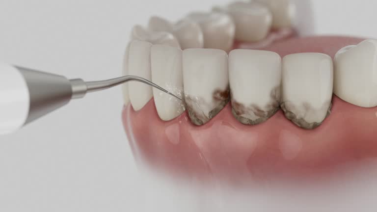 Trusted Teeth Cleaning And Checkup service in Vermillion, SD - Dentist Open Now